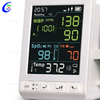 Advanced Vital Signs Monitor: Accurate Health Monitoring Solution