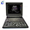 Tag Nrho Cov Xim Doppler Diagnostic System