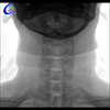 Professional X-ray System C-arm X Ray Machine for Operation manufacturers