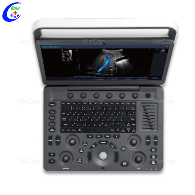 Mellor m&aacute;quina de ultras&oacute;ns port&aacute;til, Doppler cor dixital Sonoscape E2 Ultrasound Company - MeCan Medical