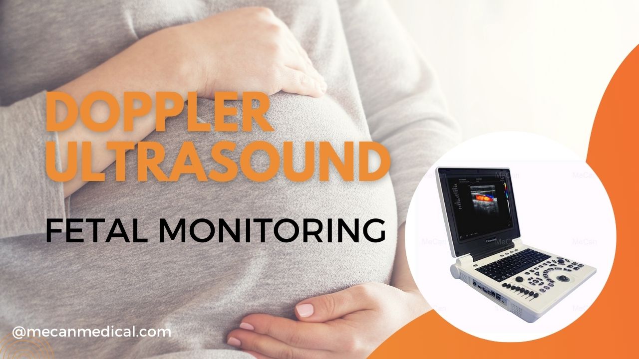 Doppler Ultrasound ဖြင့် သန္ဓေသားကို စောင့်ကြည့်ခြင်း- မျှော်လင့်နေသော မိဘများအတွက် ပြည့်စုံသော လမ်းညွှန်ချက်