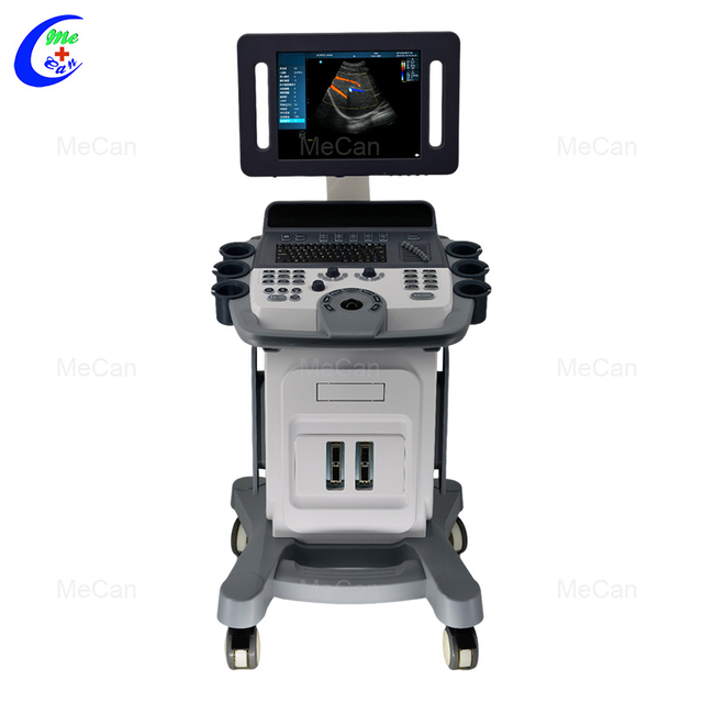 4D kocsi sz&iacute;nes Doppler ultrahang g&eacute;p