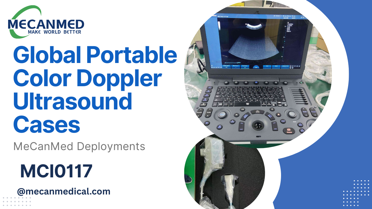 Casi Global Portable Ultrasound Doppler Color | Implementazioni MeCanMed