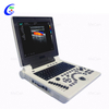 Teljes digit&aacute;lis sz&iacute;nes Doppler diagnosztikai rendszer