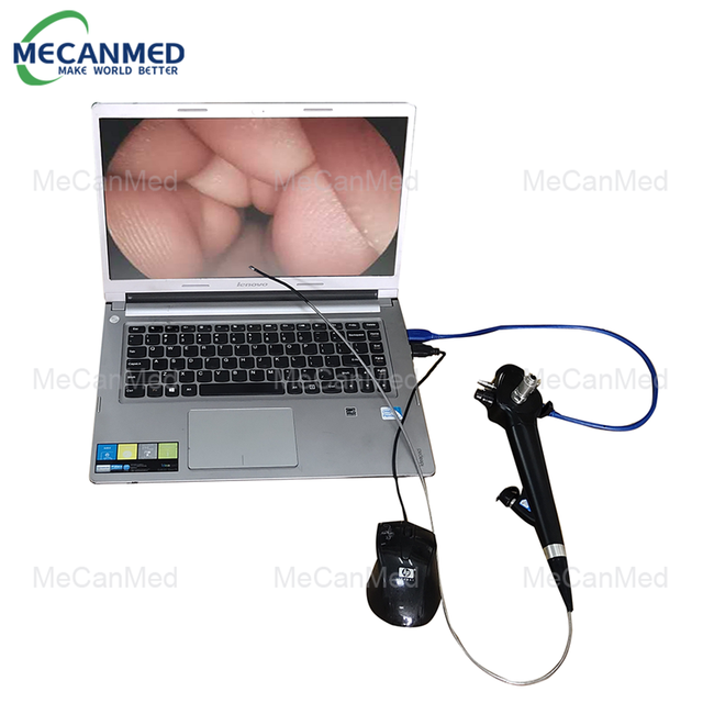 منظار البلعوم الأنفي المحمول USB