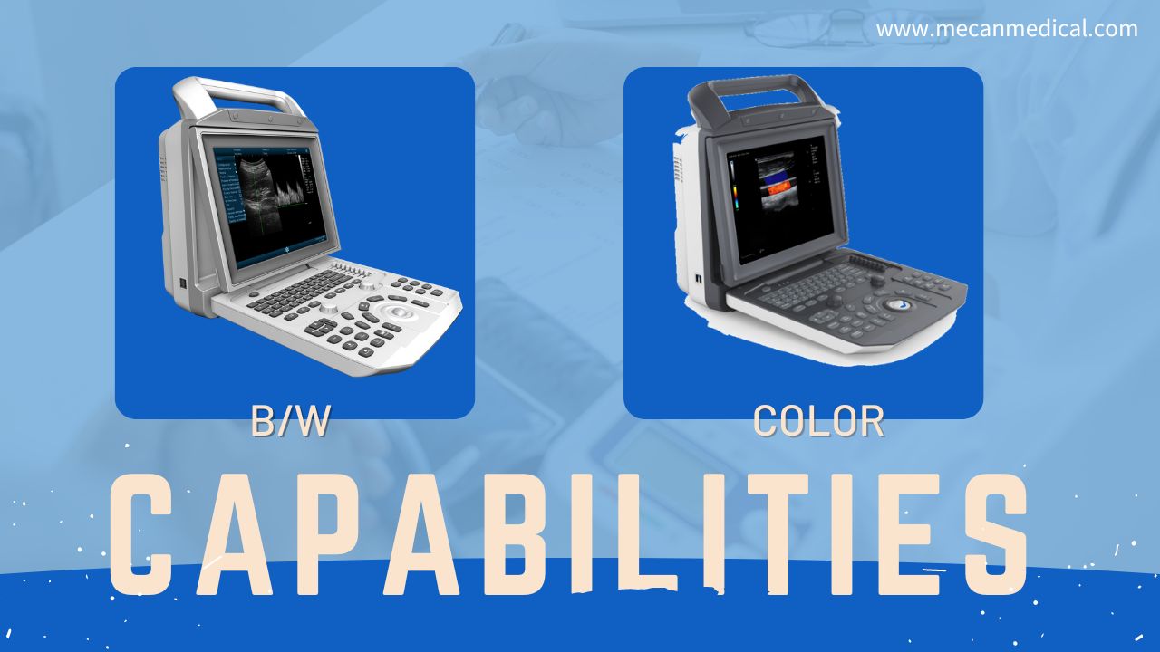 УЗИ ва допплери ранга B/W