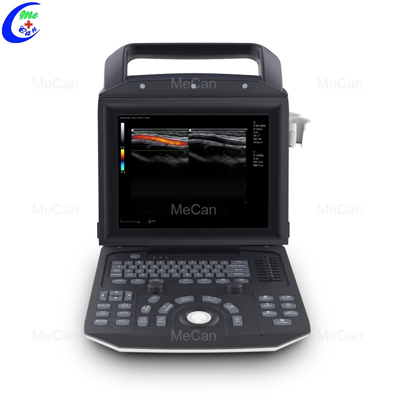 ​3D 4D Color Doppler Ultrasound Machine MeCan Medical