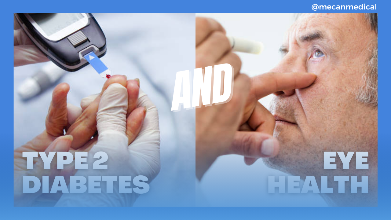 טיפּ 2 צוקערקרענק און זייַן פּראַל אויף אויג געזונט