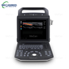 Mfumo wa Uchunguzi wa Kitaalamu Kamili wa Rangi wa Dijiti wa Doppler Ultrasonic, watengenezaji wa Kichanganuzi cha Ultrasonic kinachobebeka