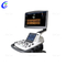 Best Quality Medical Ultrasound Scanner Portable Color Doppler Ultrasound Scanner Trolley Factory