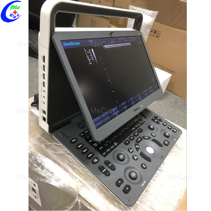 Best Portable Ultrasound Machine, Digital Color Doppler Sonoscape E2 Ultrasound Company - MeCan Medical
