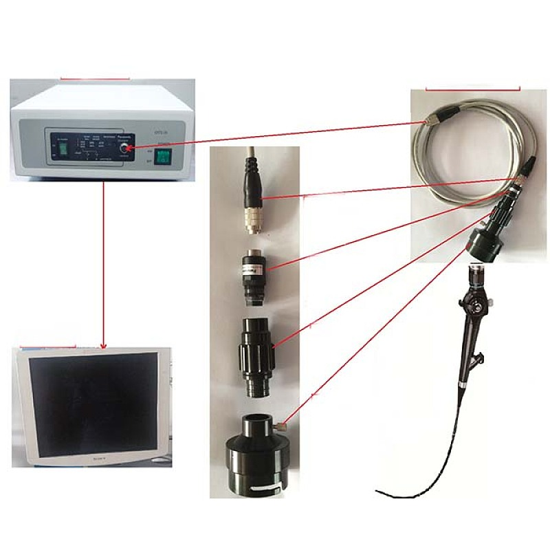 Customized Flexible fiber optic laryngoscope endoscope ,video laryngoscope price manufacturers From China