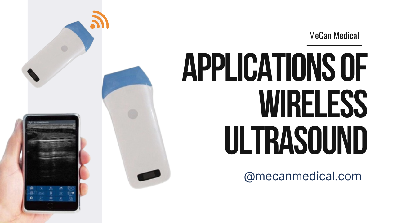 무선 초음파의 응용 탐색