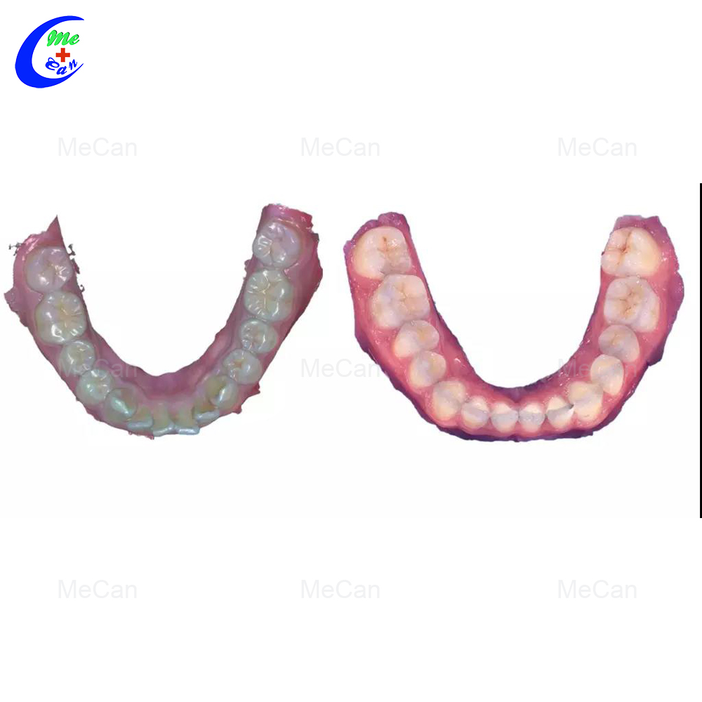 Professional Dental Equipment Poratble 3D Intraoral Scanner manufacturers