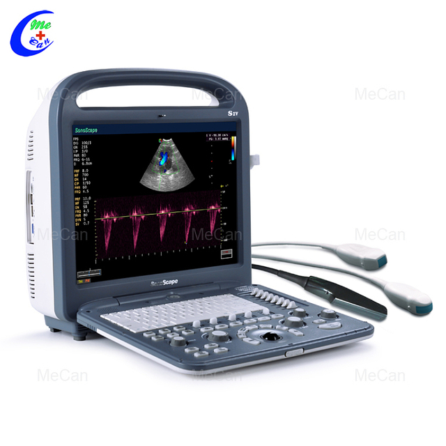 تھوک ویٹ پورٹ ایبل الٹراساؤنڈ سکینر اینیمل ویٹرنری پورٹ ایبل کلر ڈوپلر الٹراساؤنڈ مشین سونوسکیپ S2V اچھی قیمت کے ساتھ - MeCan میڈیکل