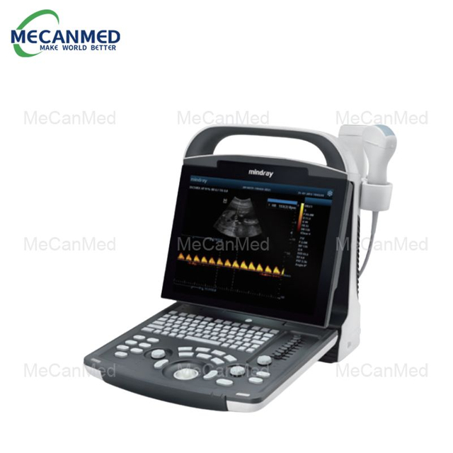 Mindray DP-10 پورٽبل ڊجيٽل الٽراسائونڊ سسٽم