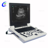 Teljes digit&aacute;lis sz&iacute;nes Doppler diagnosztikai rendszer