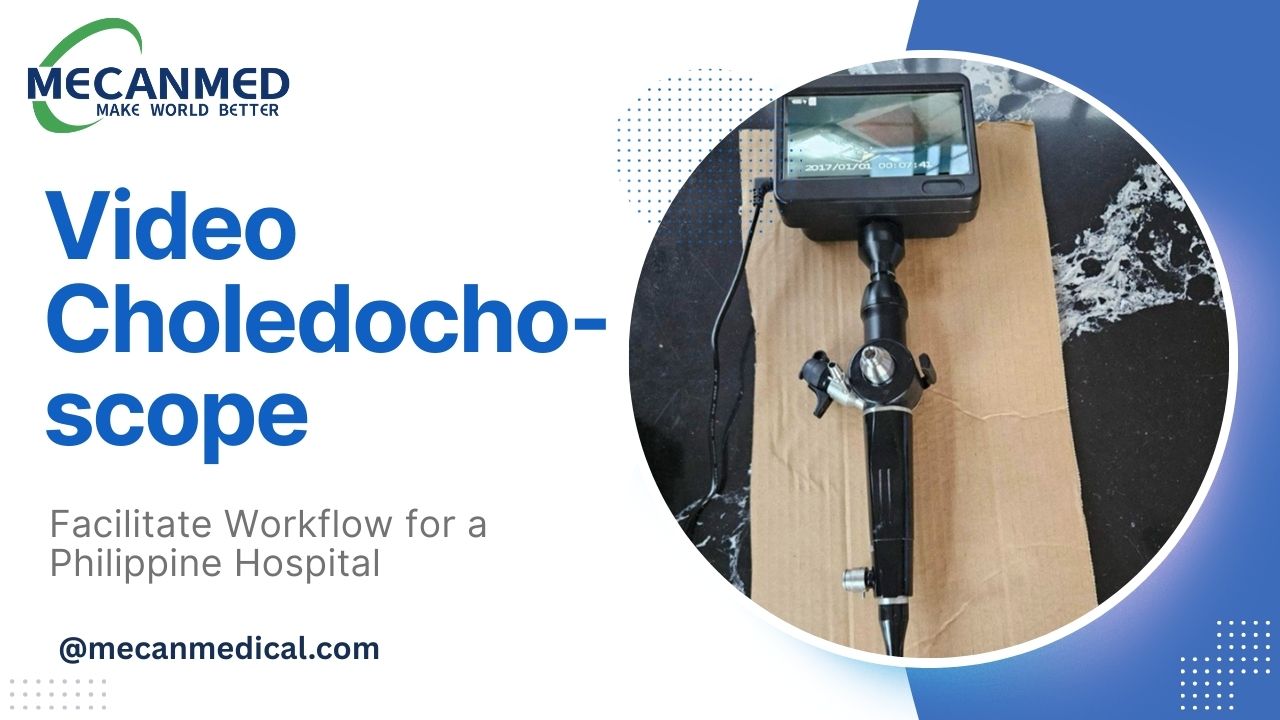 Videocoledocoscopio para o hospital filipino: facilitando o fluxo de traballo