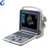 Manifattur tal-Magni tal-Ultrasound Doppler tal-Kwalit&agrave; tal-Kulur | MeCan Mediku