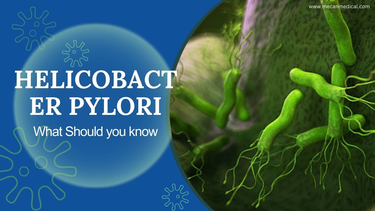 Co byste měli vědět o Helicobacter pylori