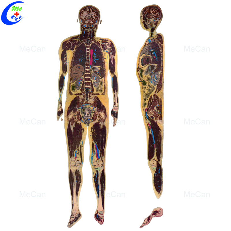 Best Quality 3D Printing High-definition Human Tansection Layer Model Factory