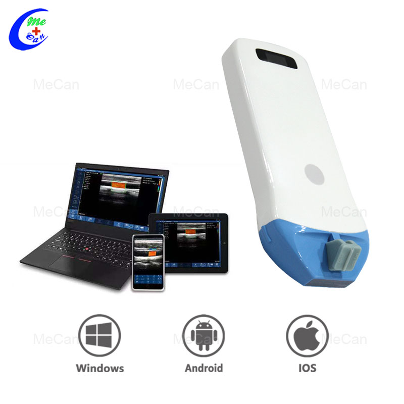 Quality Linear Series Portable Wifi Ultrasound Scanner Manufacturer | MeCan Medical