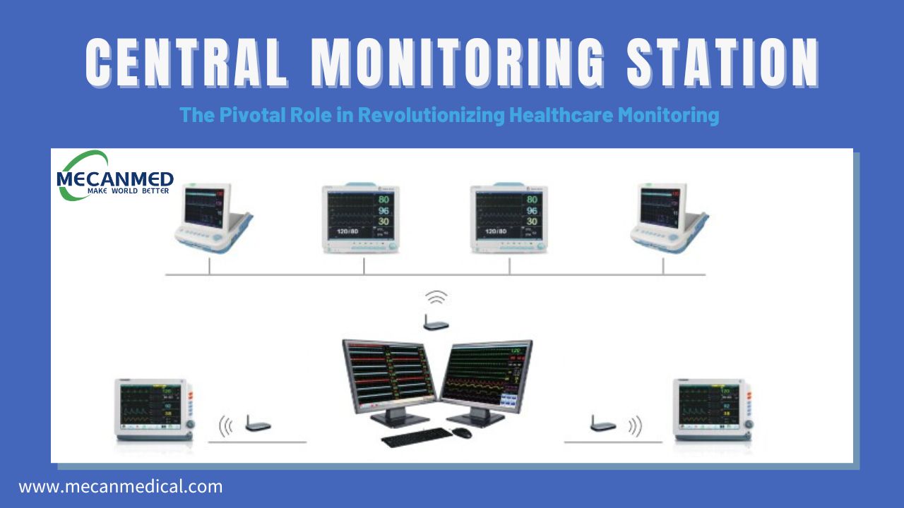 Κεντρικός Σταθμός Παρακολούθησης: Ο κεντρικός ρόλος στην επανάσταση στην παρακολούθηση της υγειονομικής περίθαλψης