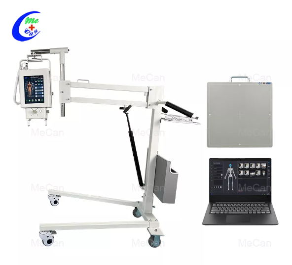 Kolik stoj&iacute; přenosn&yacute; rentgenov&yacute; syst&eacute;m?