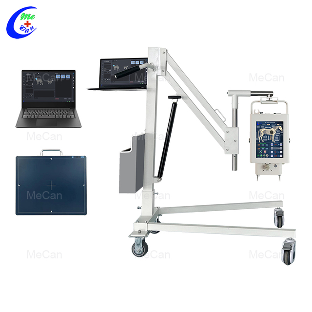 Sistema de raios X DR port&aacute;til de 5,6 kW