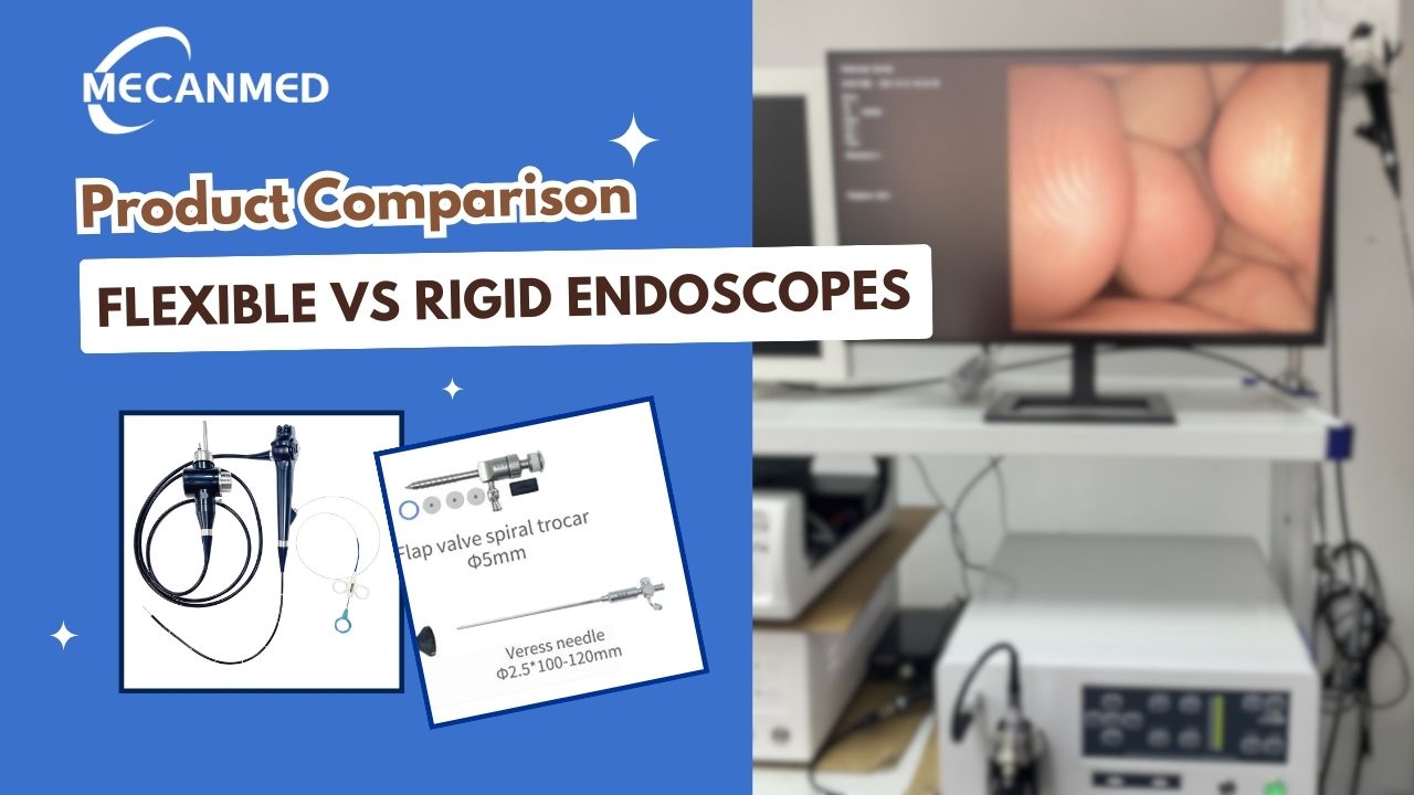 A rugalmas endoszk&oacute;pok &eacute;s a merev endoszk&oacute;pok előnyei