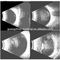 Professional MCE-6000AB Portable AB Scanner Ophthalmic Ultrasound manufacturers