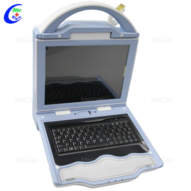 Автоматичний високоефективний ультразвуковий кістковий денситометр